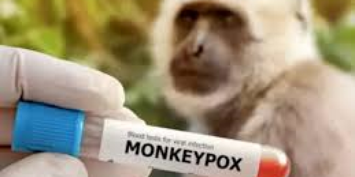 Monkey Pox Virus